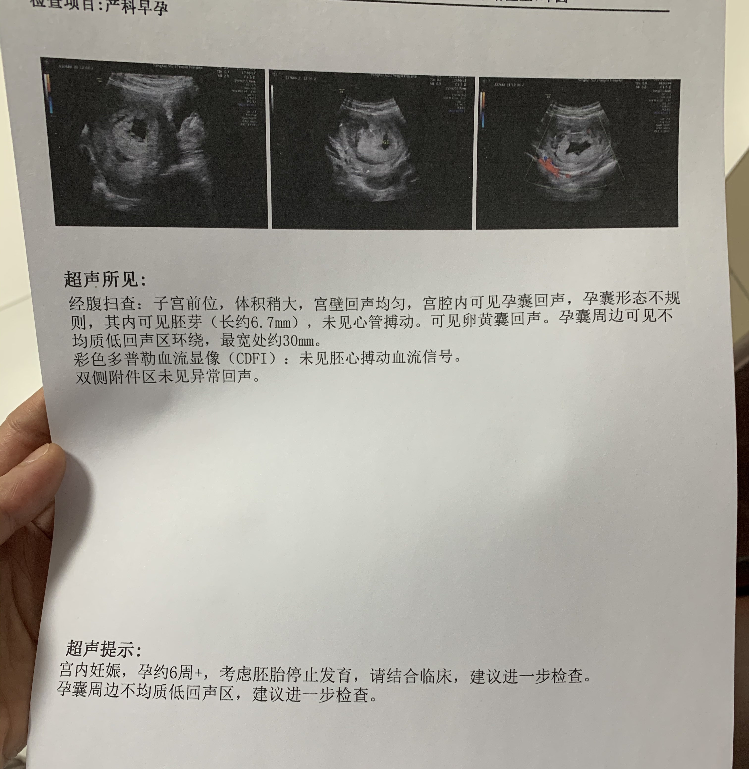 第一次怀孕就遇到胎停- 健康160