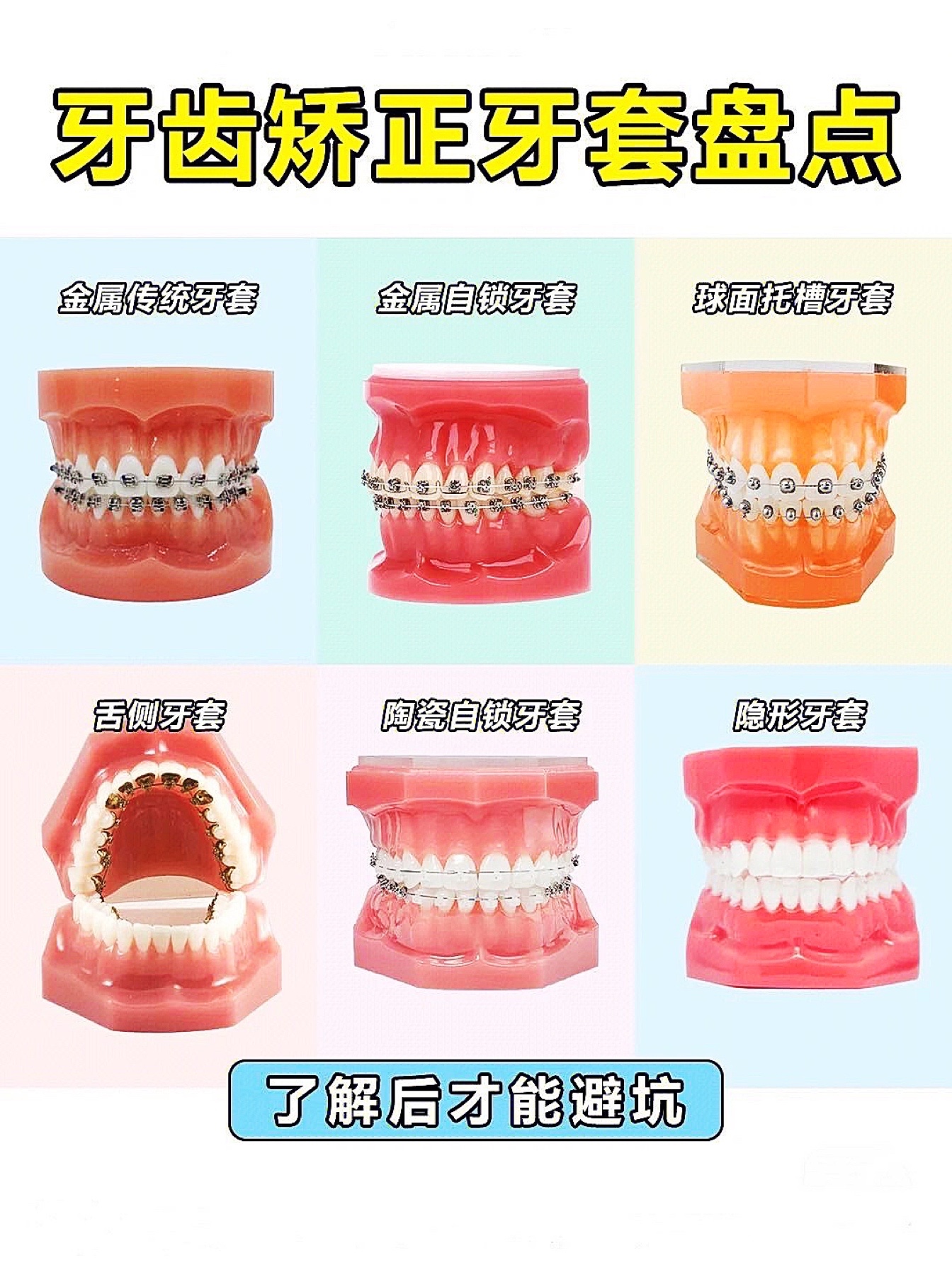牙齿矫正有哪些种类大比拼💁- 健康160