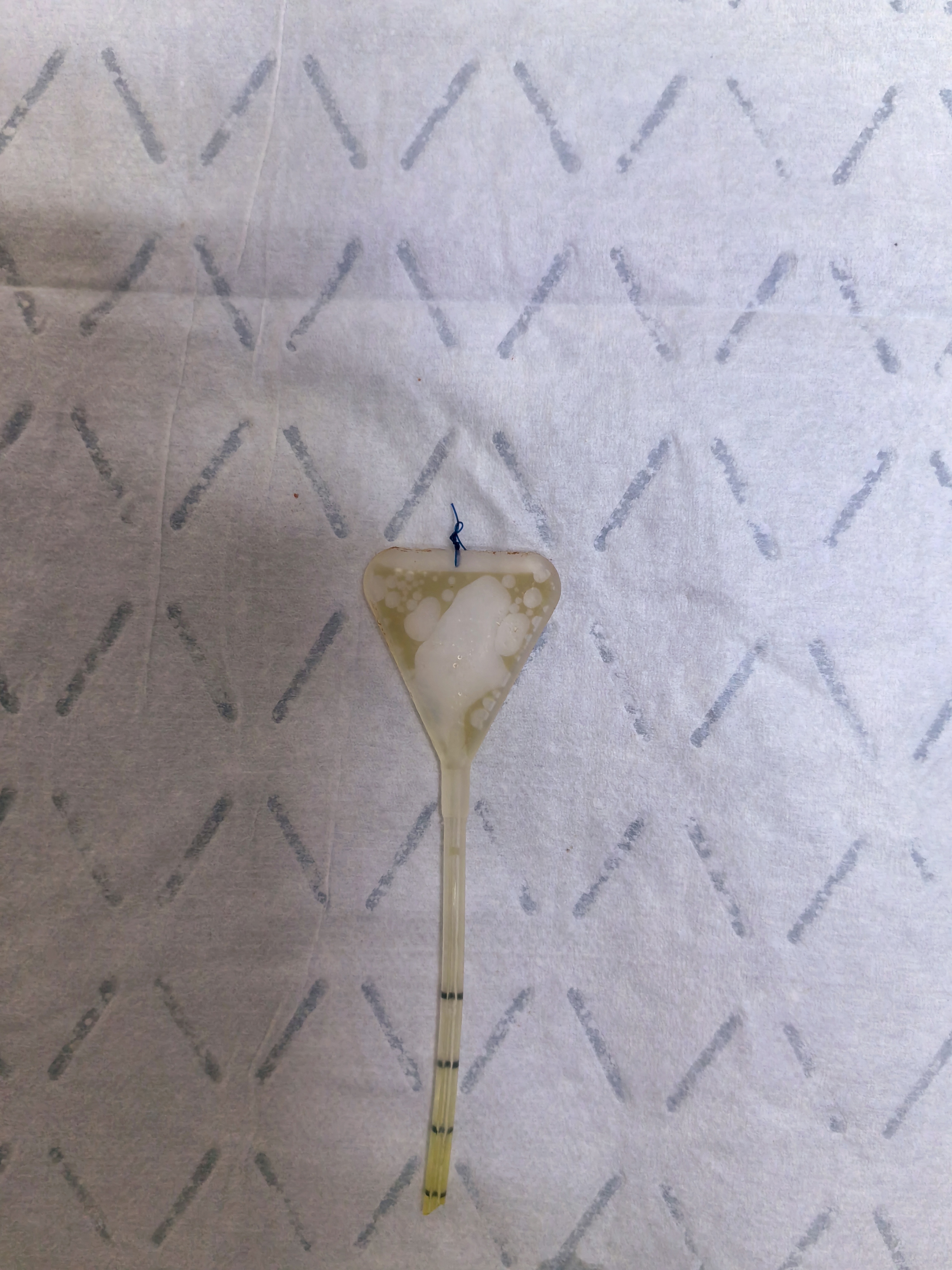 宫腔粘连因为球囊支架脱落而粘连失败,行宫腔镜下缝合术固定后,顺利