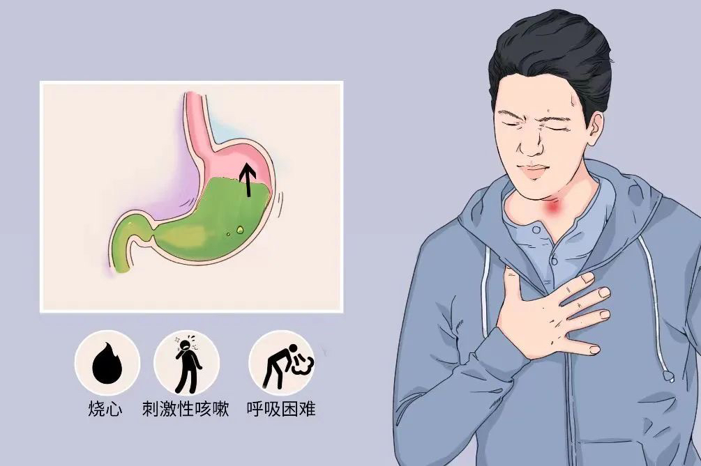 久咳不止怎么办?不同的咳嗽表现代表什么?- 健康160