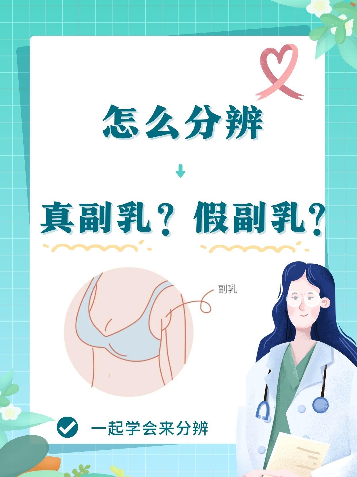 副乳会遗传吗图片